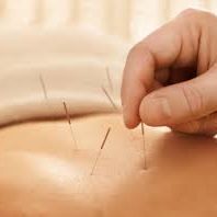 acupunture 2